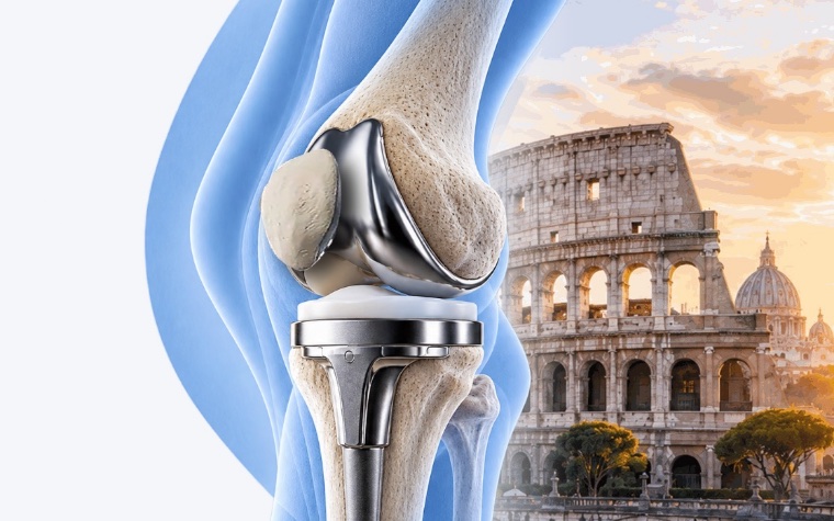 A total knee replacement beside the Colosseum in Rome
