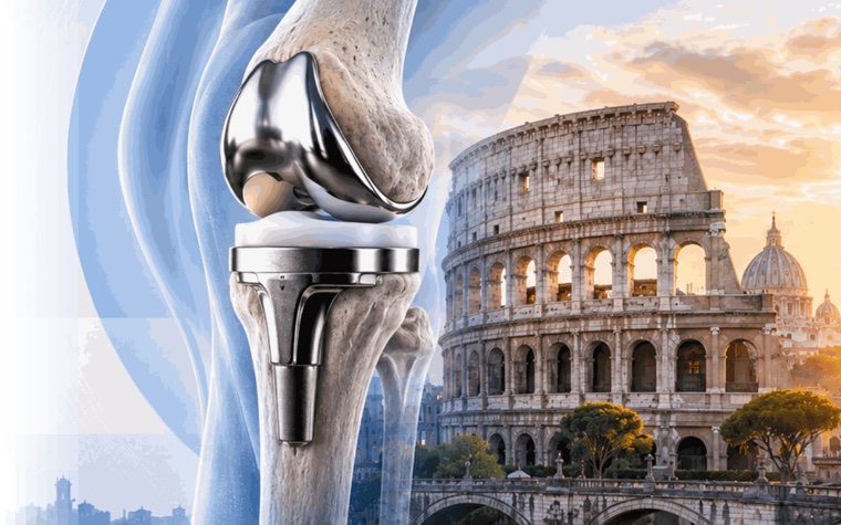 A knee replacement implant beside the Colosseum in Rome